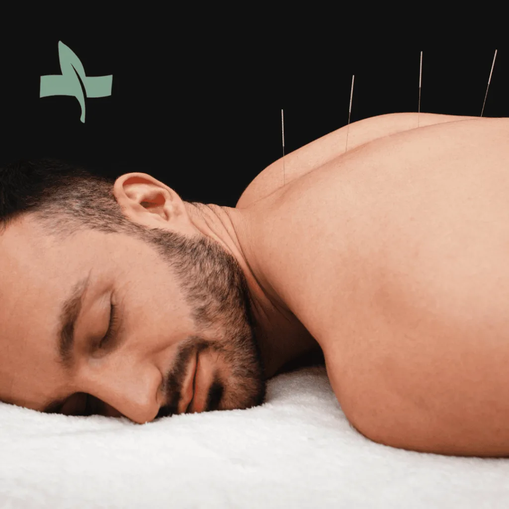 Man resting during acupuncture treatment