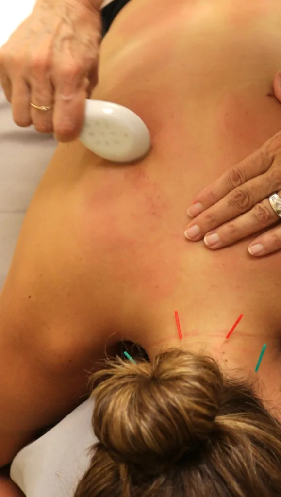 patient receiving gua sha treatment